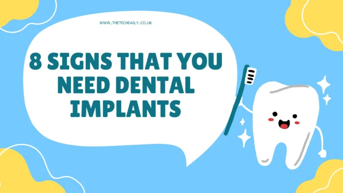 8 Signs That You Need Dental Implants